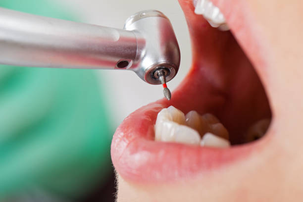 Best Weekend Emergency Dentist in Brownsburg, IN